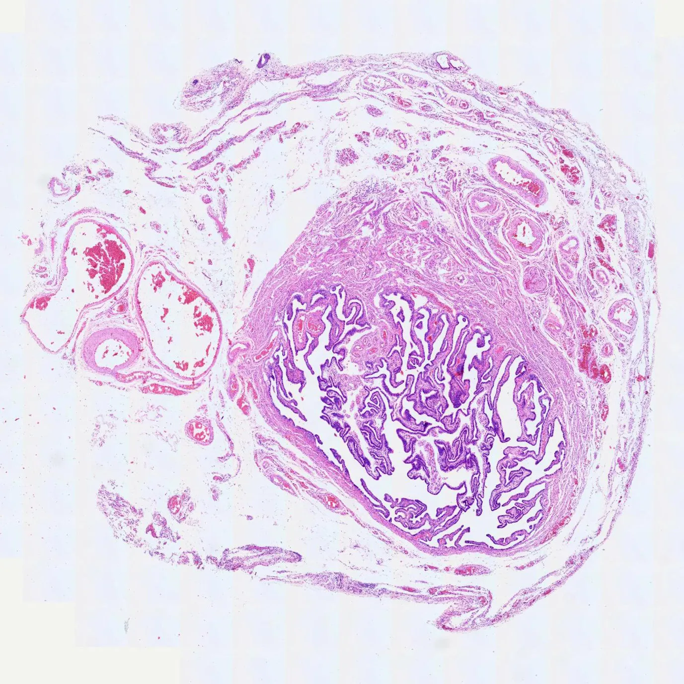 Fallopian tube prepared microscope slide