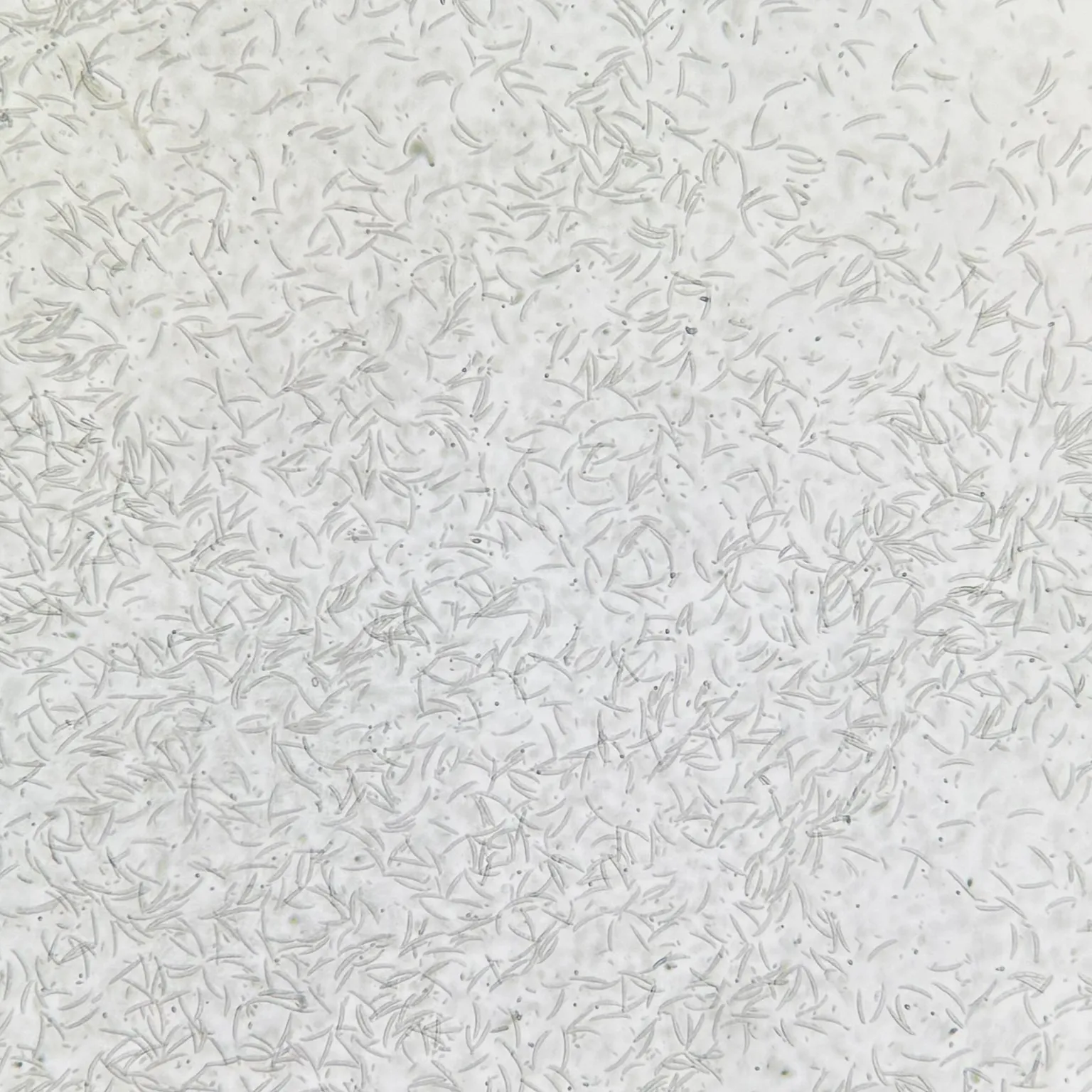Fusarium oxysporum Prepared Microscope Slide