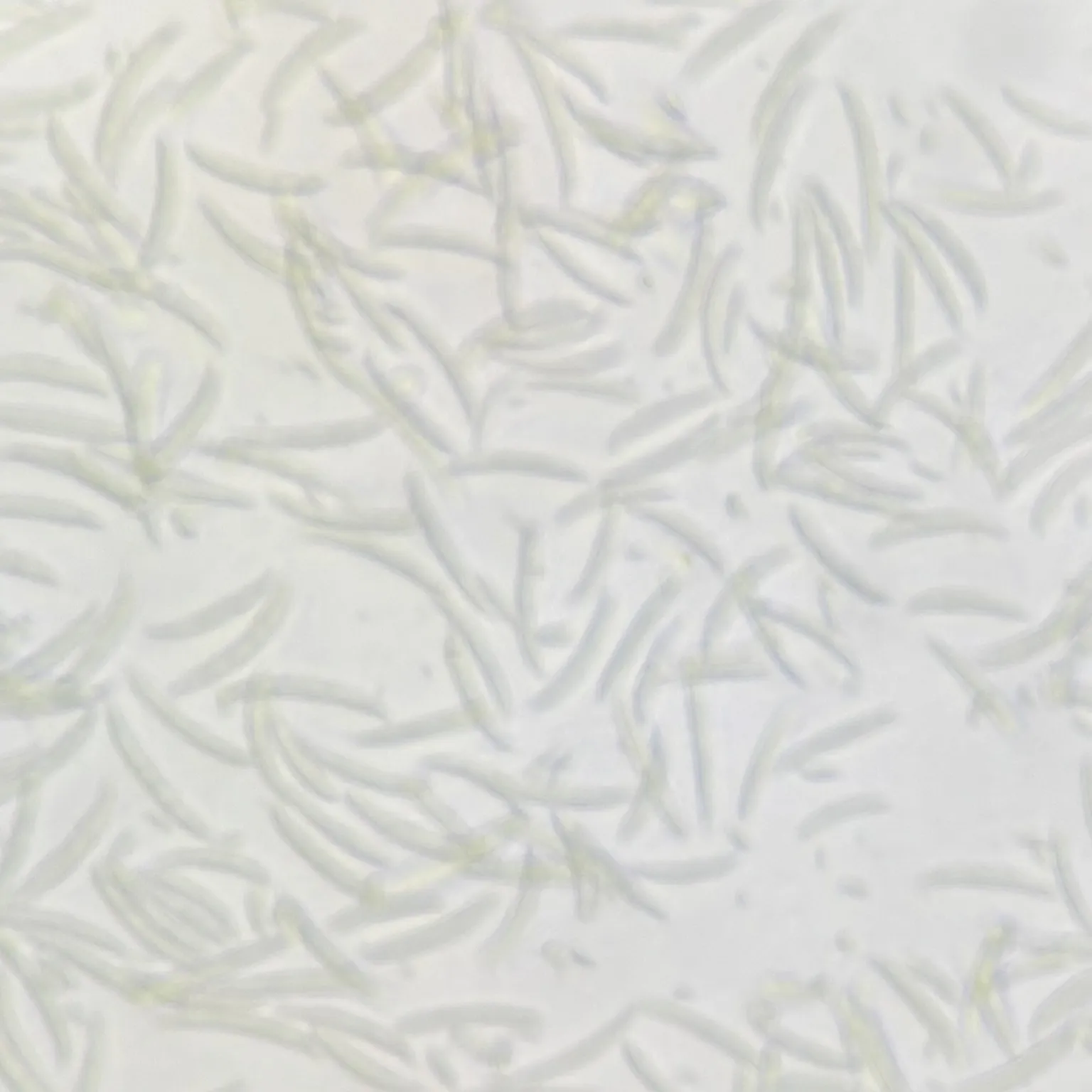 Fusarium oxysporum