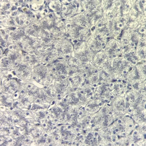 Liver Mitochondria