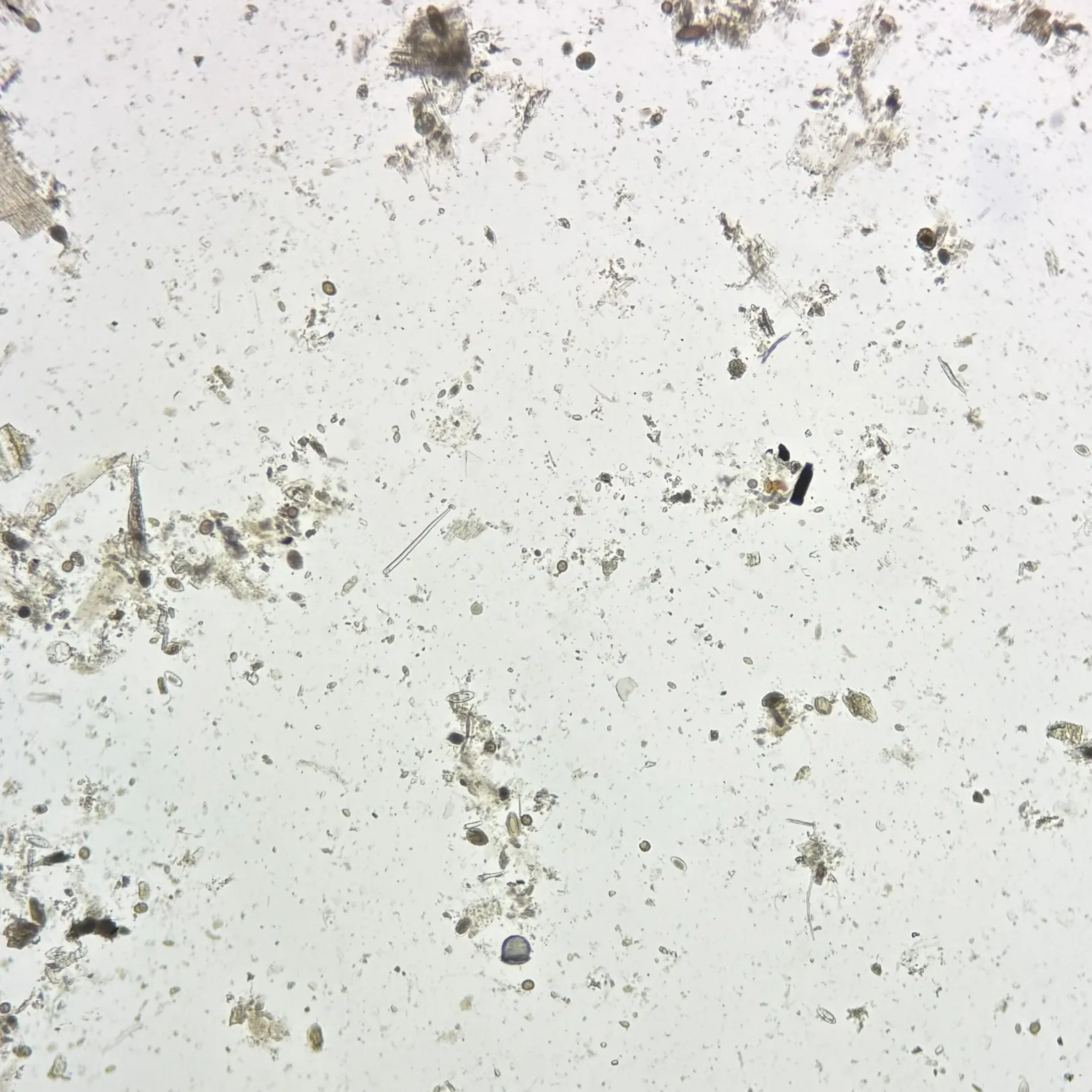 Mixed parasitology ova prepared microscope slide