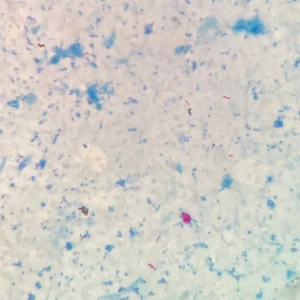 Mycobacterium tuberculosis prepared slide