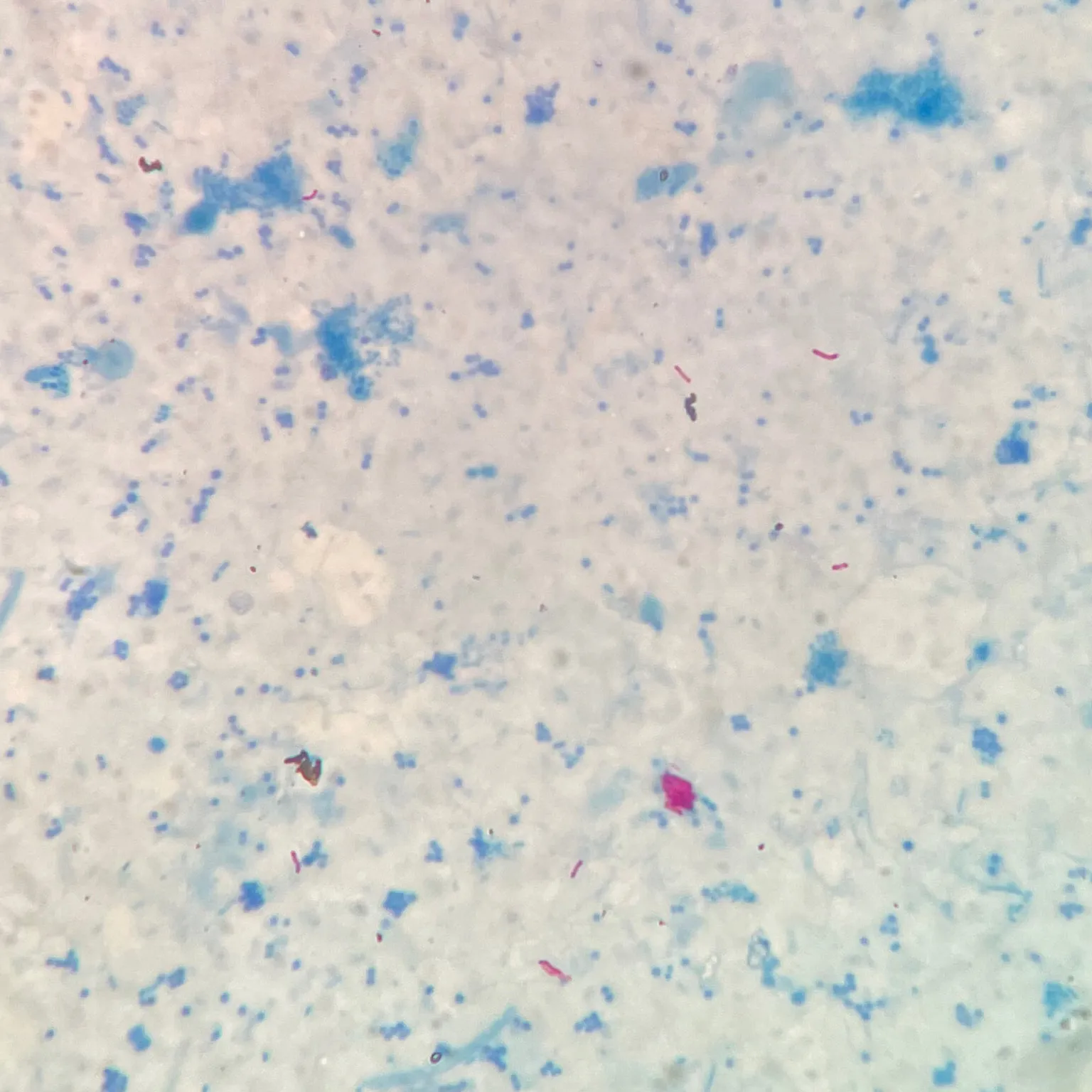 Mycobacterium tuberculosis prepared slide